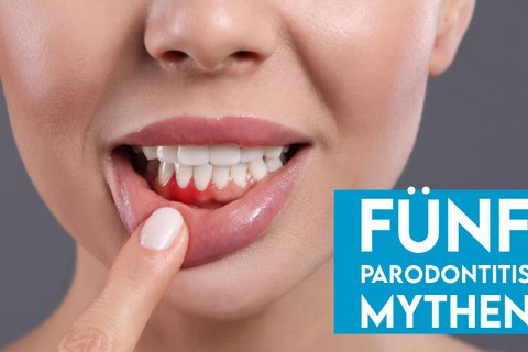 Frau mit geöffnetem Mund zeigt auf entzündetes Zahnfleisch